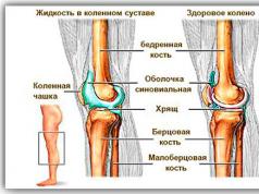 Exsudatívna proliferatívna synovitída kolena