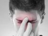 Miostitové oko svaly Symptómy Liečba Miositída Oči Príznaky