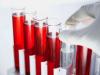 C-reaktívny proteín v krvi: norma v testoch, prečo stúpa, úloha v diagnostike